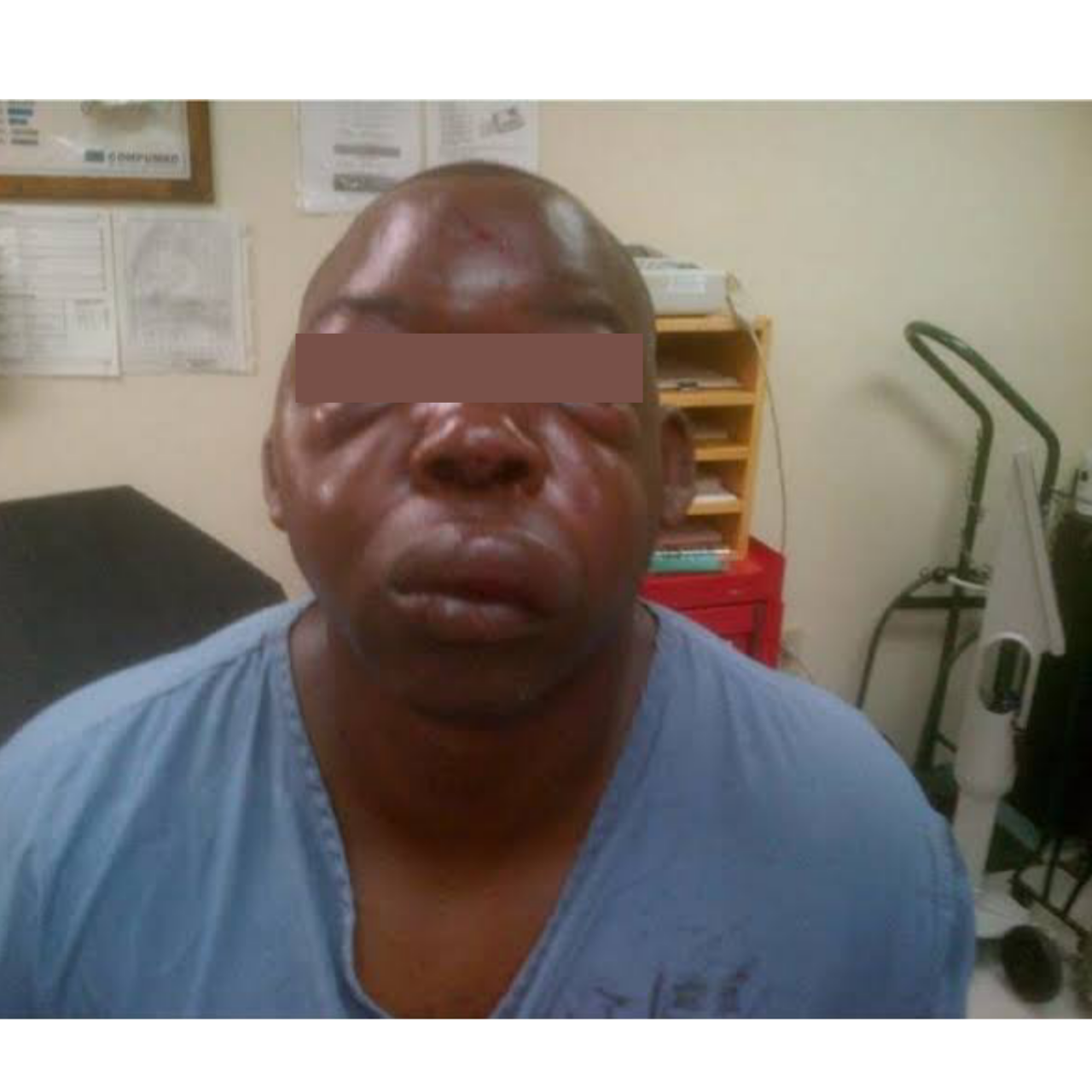 Diabetics kidney Disease